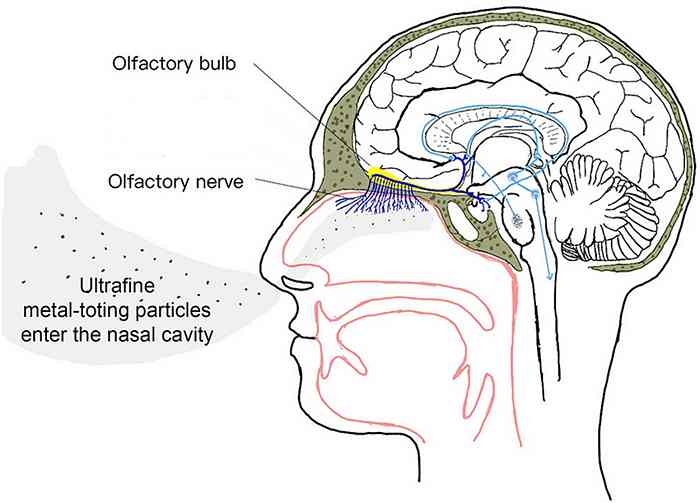 Nanoparticles of metal enter the brain via the nose